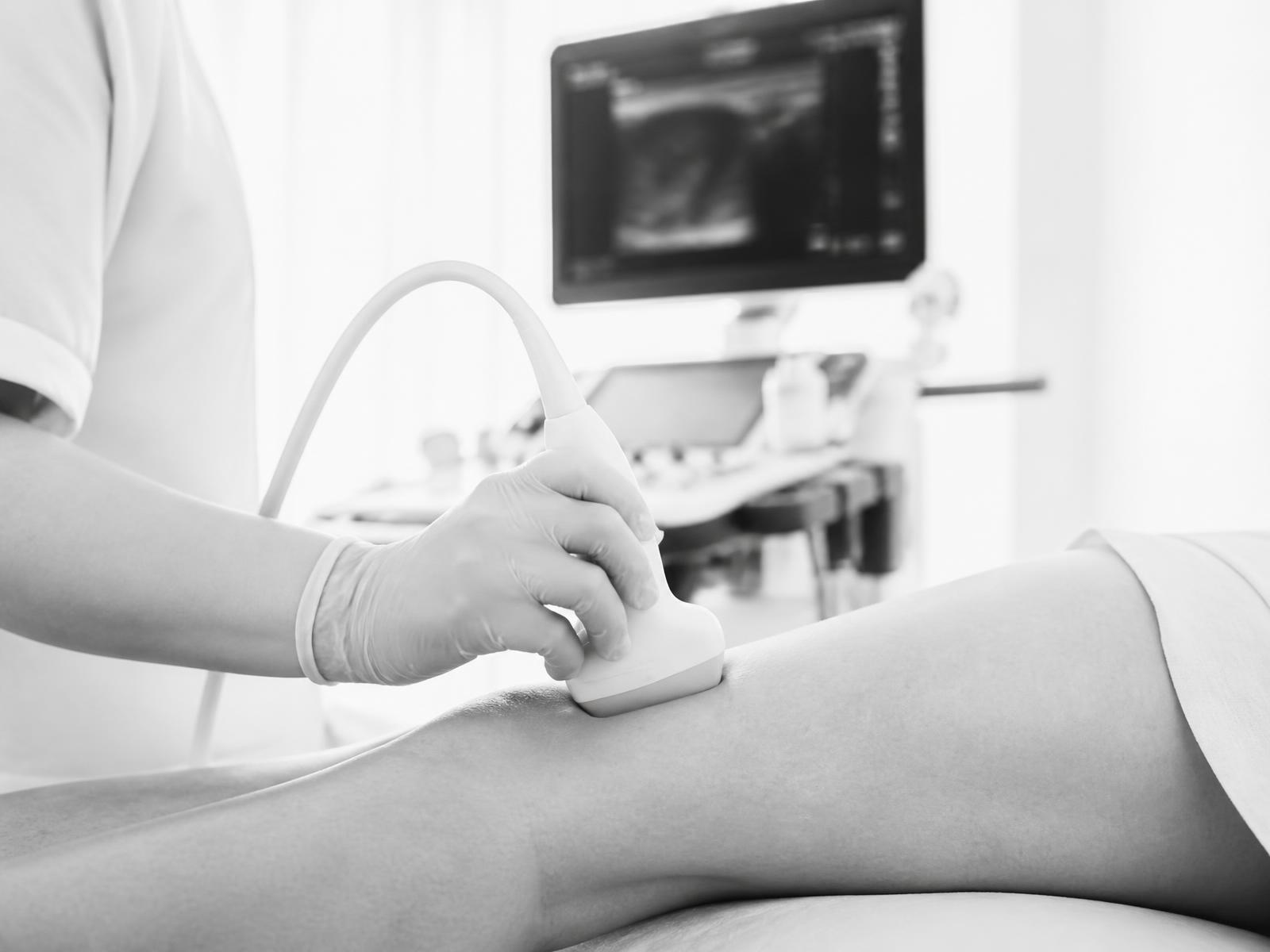 Exame vascular com ultrassom doppler na perna do paciente durante a avaliação